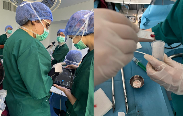 لأول مرة في المستشفيات العمومية: اعتماد تقنية جديدة لاستئصال سرطان الرئة بالتبريد في مستشفى عبد الرحمان مامي