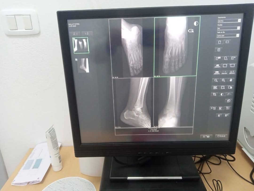 خدمات تصوير وتحاليل أقرب للمواطنين في نابل