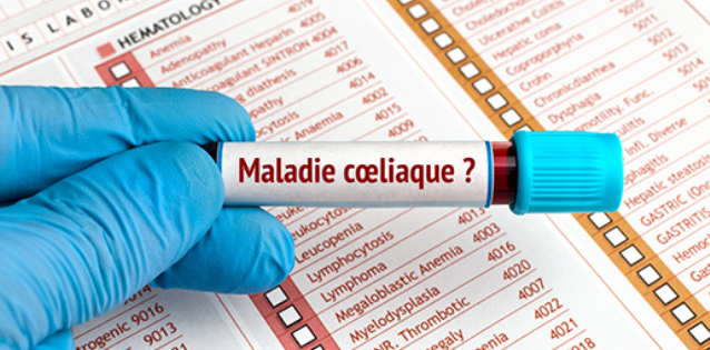 Maladie cœliaque : une réalité invisible pour des milliers de Tunisiens