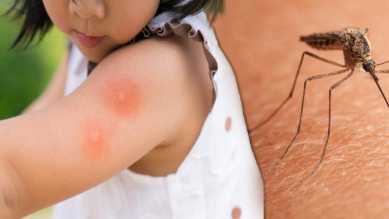 وزارة الصحّة تُــقدّم جملة من التوصيات للحماية من الناموس والأمراض المنقولة