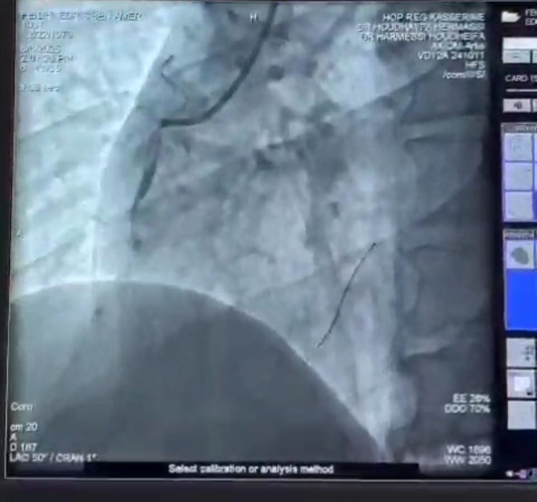 القصرين: أول نجاح طبي عبر منصة "نجدة TN"