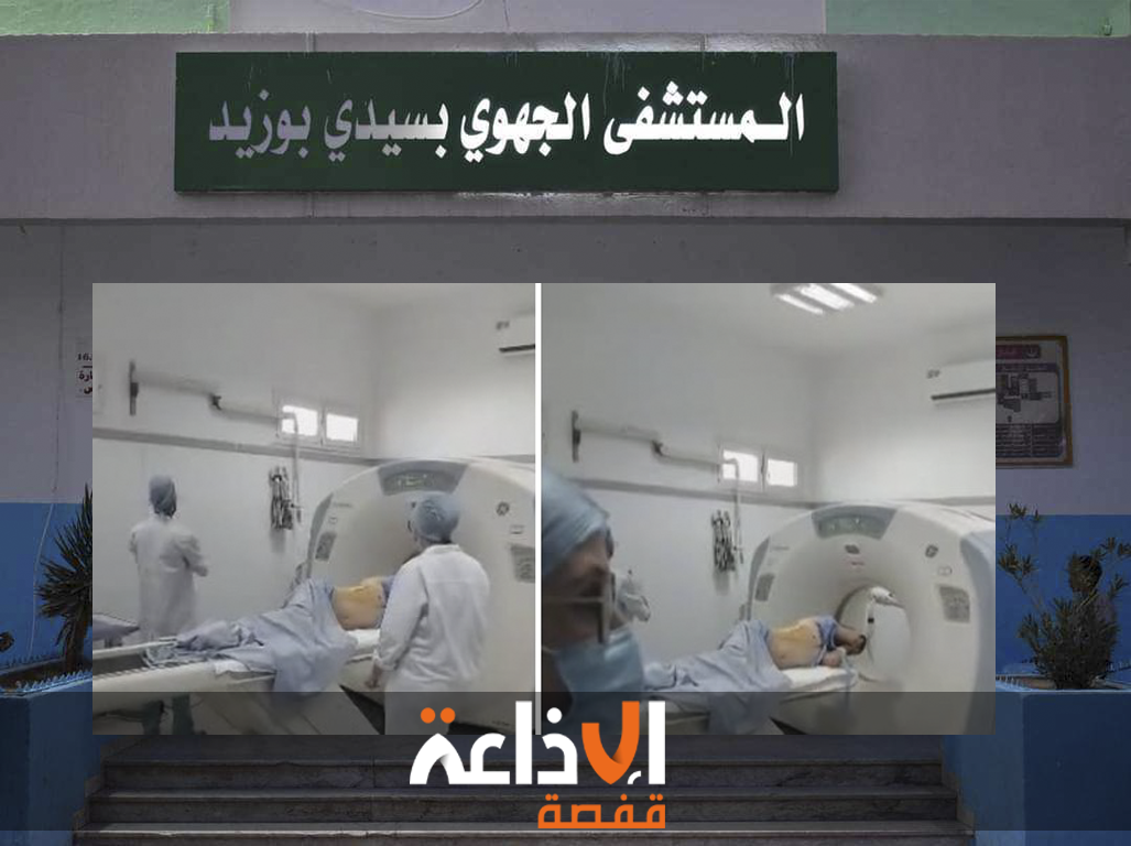 المستشفى الجهوي بسيدي بوزيد يشهد لأول مرة عملية إزالة كيس من الكبد تحت مراقبة المفراس 