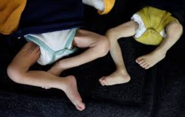 غزة: أكثر من مليون طفل يعاني من انعدام الأمن الغذائى 