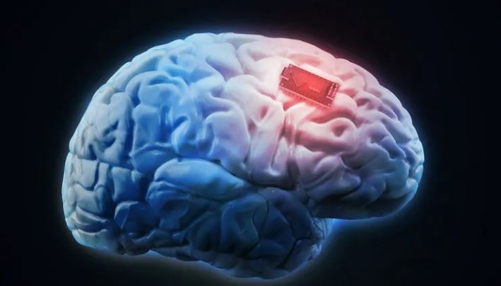 علماء يطورون أول شريحة دماغية لترجمة الأفكار إلى كلمات منطوقة