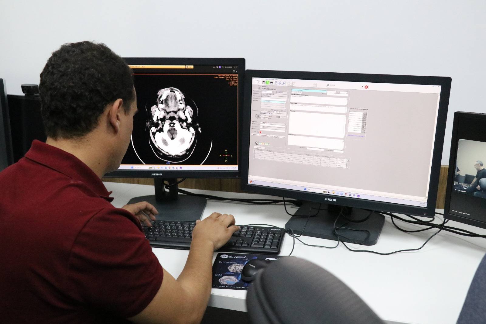 مدنين : المستشفى الجامعي يشرع في الانتفاع بخدمة التصوير الطبي (سكانار)  عن بعد التي يؤمنها المستشفى الرقمي لوزارة الصحة