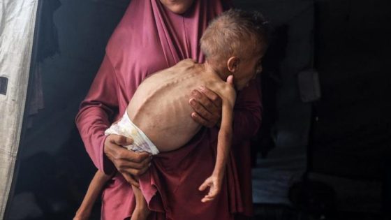 العدوان الصهيوني : استشهاد 11 فلسطينيا خلال ال24 ساعة الماضية نتيجة سوء التغذية