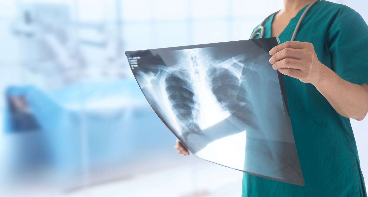 علماء روس يبتكرون مواد جديدة لأبحاث الأشعة السينية في الطب والصناعة