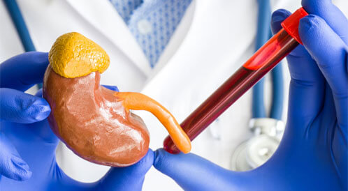 "هرمون التوتر" يهاجم صحتك! د. حنان الصيادي تكشف علامات الكورتيزول وتحذّر من مخاطره