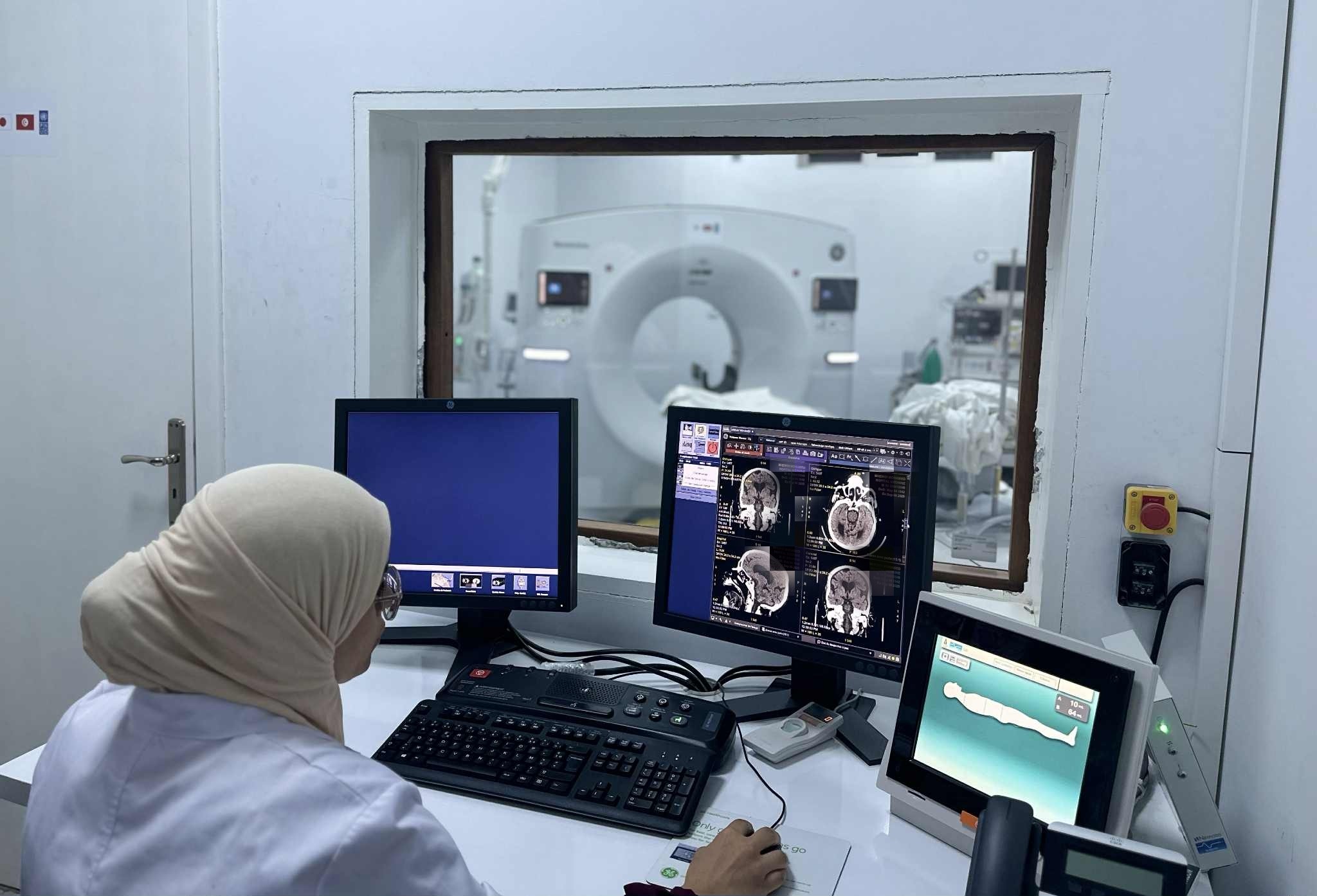 المستشفى الرقمي بوزارة الصحة: توسعة خدمات التصوير الطبي عن بعد 