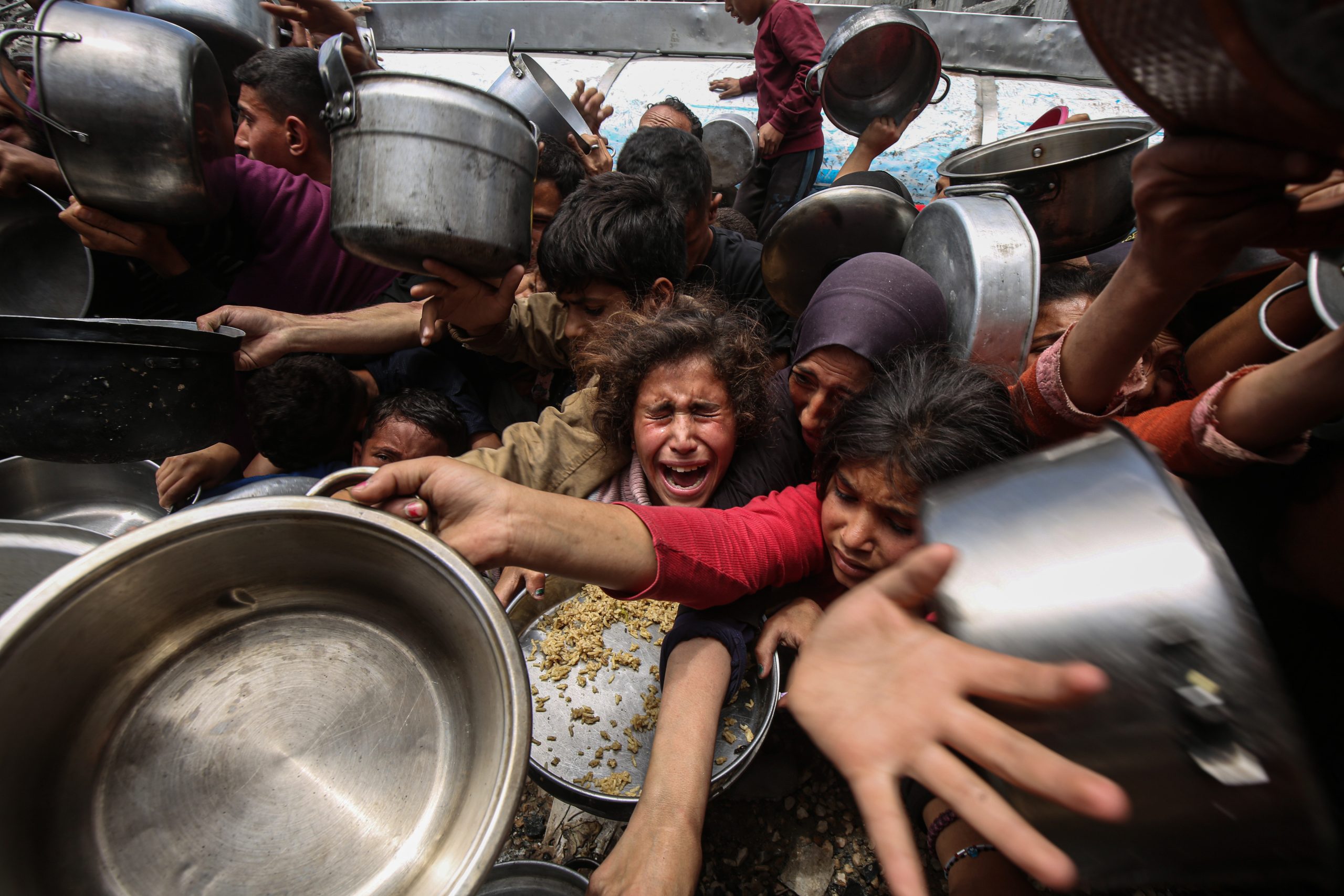 غزة: ستة شهداء من بينهم طفلان نتيجة المجاعة وسوء التغذية خلال الـ24 ساعة الماضية