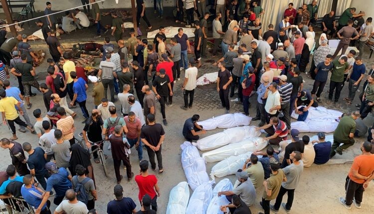 استشهاد 7 فلسطينيين بينهم طفلان خلال 24 ساعة جراء المجاعة وسوء التغذية في غزة