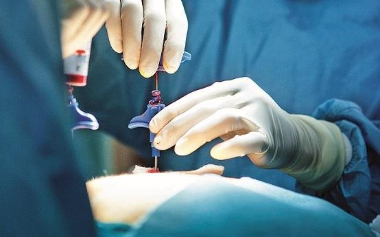 Sidi Bouzid : une première médicale réussie dans le traitement de la vésicule biliaire