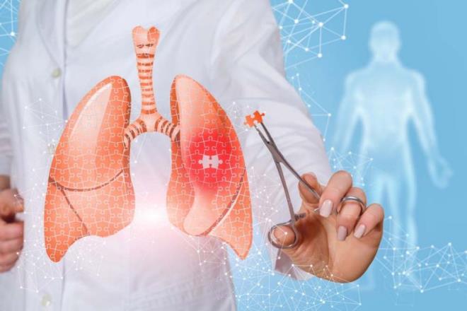 رئيس جمعية جراحة الصدر: تونس ستنطلق قريبا في إجراء تجارب نموذجية للجراحة الروبوتية في عدة اختصاصات من بينها جراحة الصدر