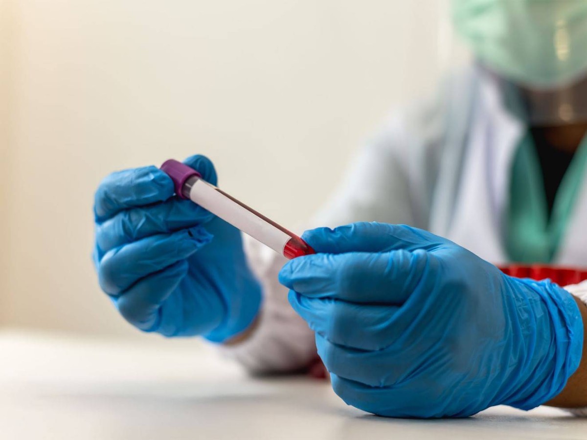 علماء يبتكرون تقنية تعزز فعالية علاج سرطان الدم