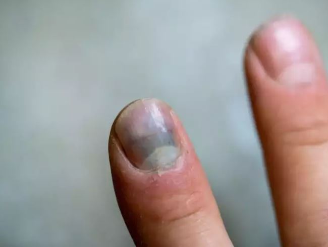 المهدية: حملة مراقبة لمنع استعمال طلاء اظافر ومواد لفرد الشعر تحتوي على مواد كيميائية مسرطنة.