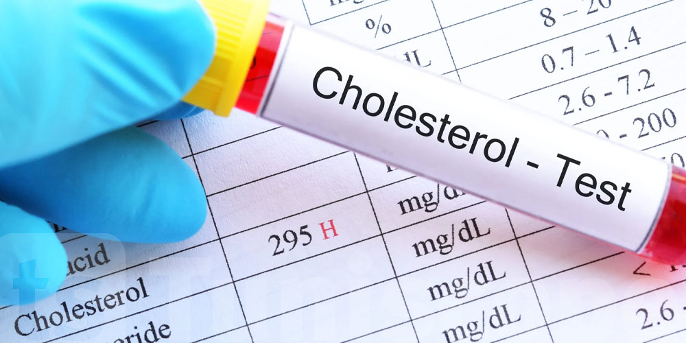 8 عادات صباحية ترفع مستوى الكوليسترول الضار لديك