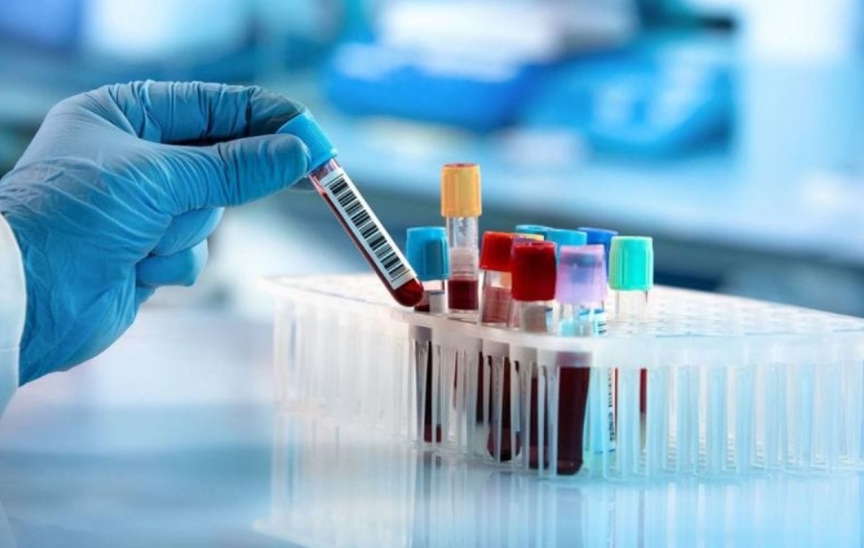 نقابة البيولوجيين الخواص تدعو ’’الكنام’’ إلى تسديد مستحقات المخابر الطبية