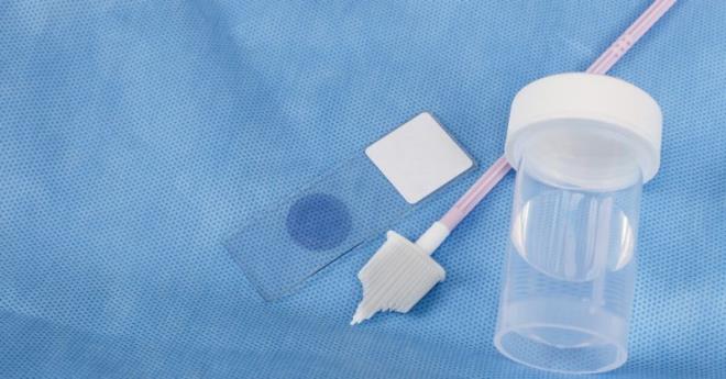 نسبة اجراء اختبار الكشف عن سرطان عنق الرحم في تونس لاتتجاوز 14 إلى 16 بالمائة