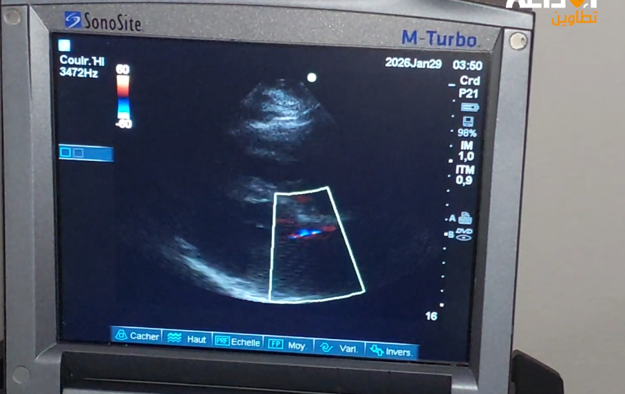 "قافلة القلب" تحلّ بالمستشفى المحلّي ببني خداش من ولاية مدنين