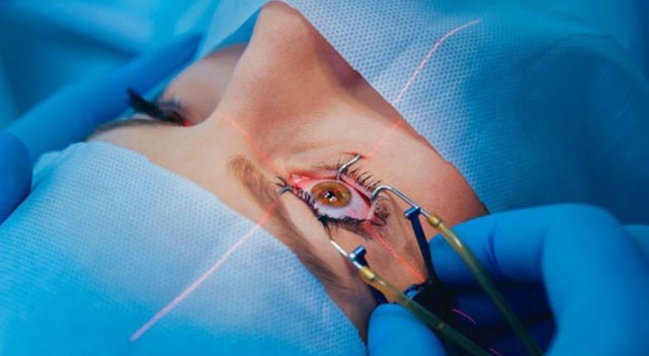 قافلة صحية تضامنية: : إجراء 31 عملية لإزالة الماء الأبيض من العين