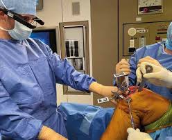 Jendouba : succès d’une première opération de prothèse totale de genou