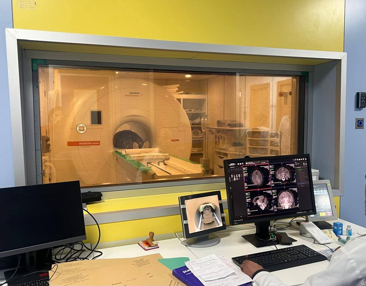  انطلاق وحدة الرنين المغناطيسي المتطور (IRM 3Tesla) بالمعهد الوطني المنجي بن حميدة