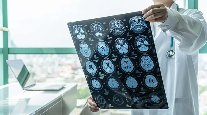 تونس تستعد لاحتضان الاجتماع 52 للجمعية الأوروبية لطب أعصاب الأطفال لأوّل مّرة خارج أوروبا من 26 الى 28 مارس 2026