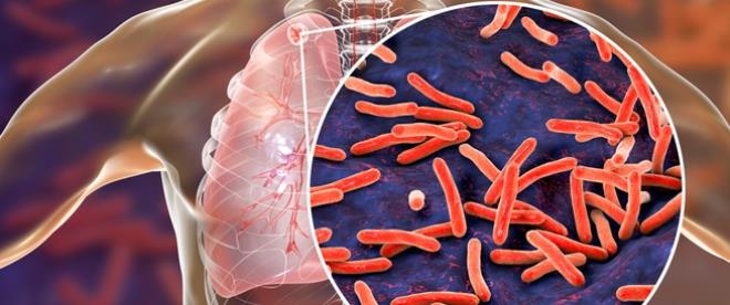 اليوم العالمي لمكافحة السل: عميد الأطباء البيطريين يؤكد أن القضاء على السل العقدي ممكن عبر تكريس مفهوم الصحة الواحدة