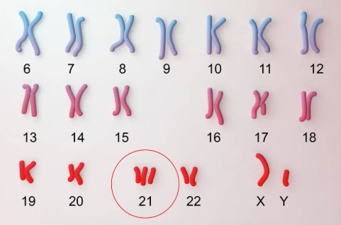 الأربعاء المقبل: أمسية علمية حول التثلث الصبغي 21 لدعم التكوين المستمر وتبادل الخبرات العلمية